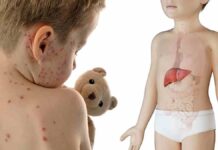 Viagra Ingredient Sildenafil Shows Remarkable Promise Treating Deadly Childhood Disease Leigh Syndrome